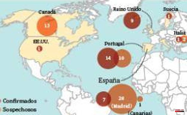 Madrid links monkeypox outbreak to 'chemsex' parties