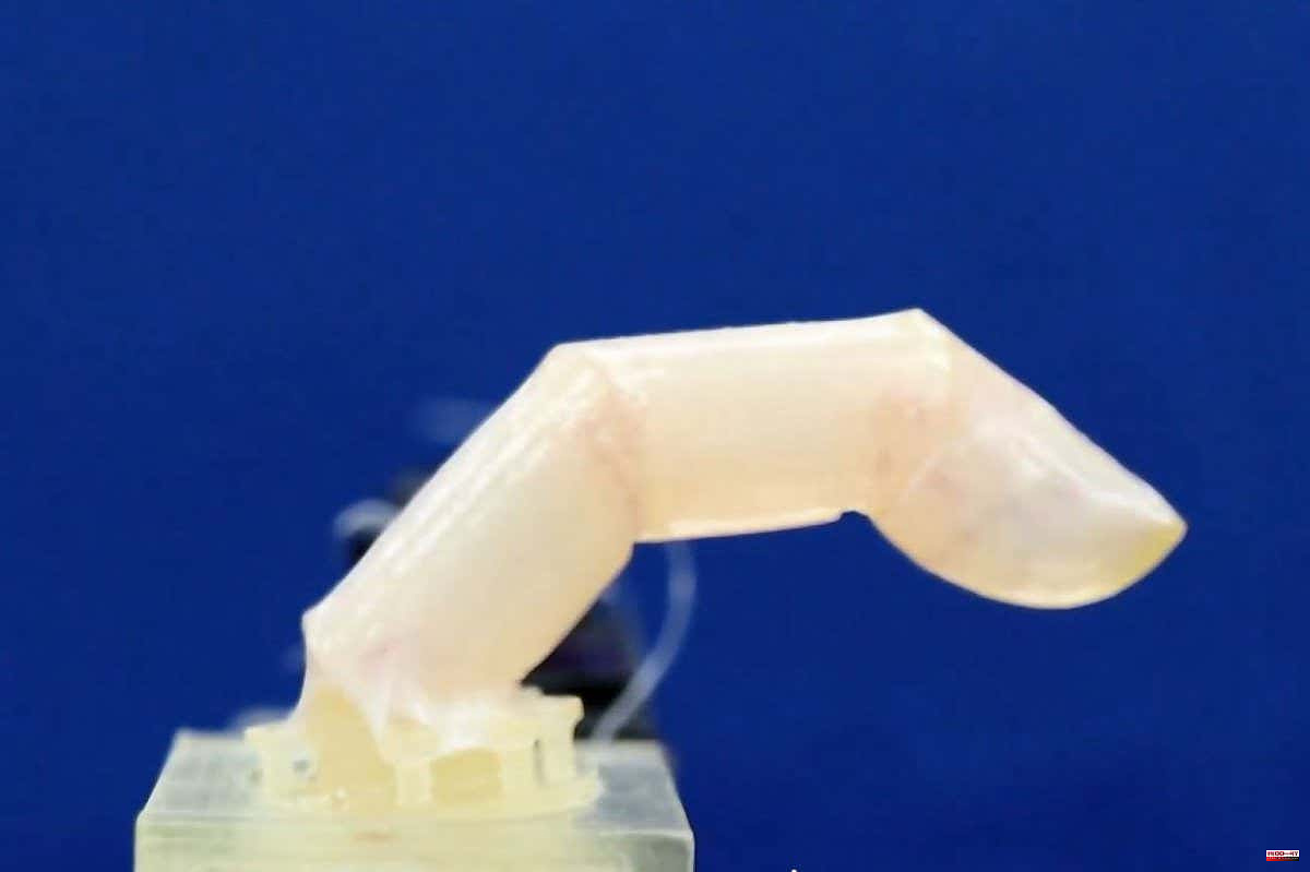 Scientists covered a robotic finger with living human skin

