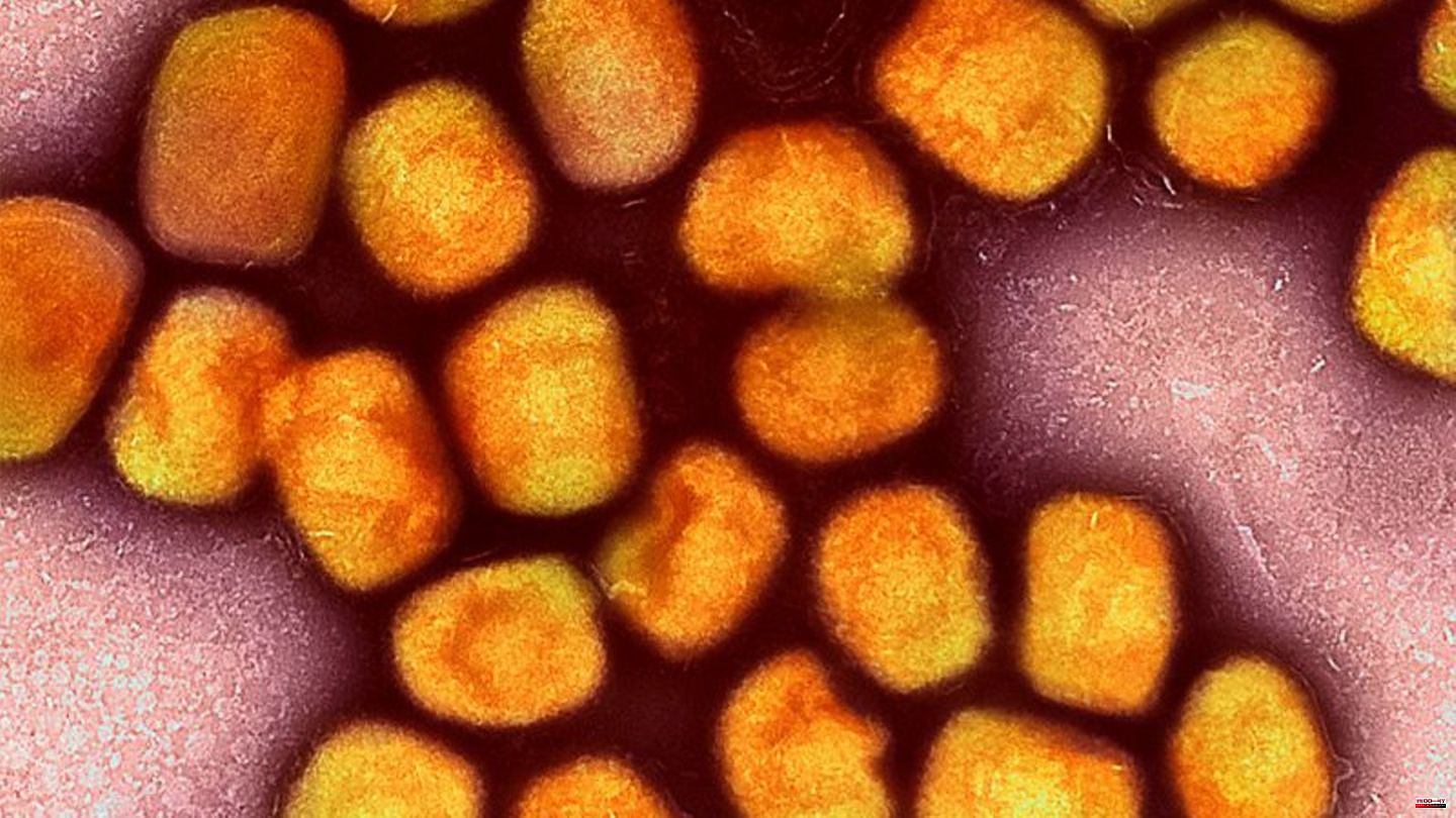 Virus: 14 monkeypox cases in Saxony-Anhalt known so far