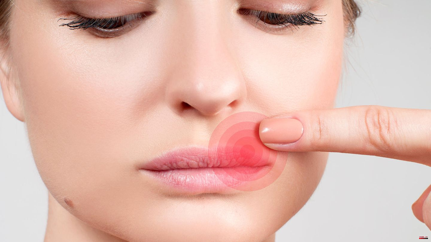 Viral infection: what helps against herpes? How to properly treat cold sores