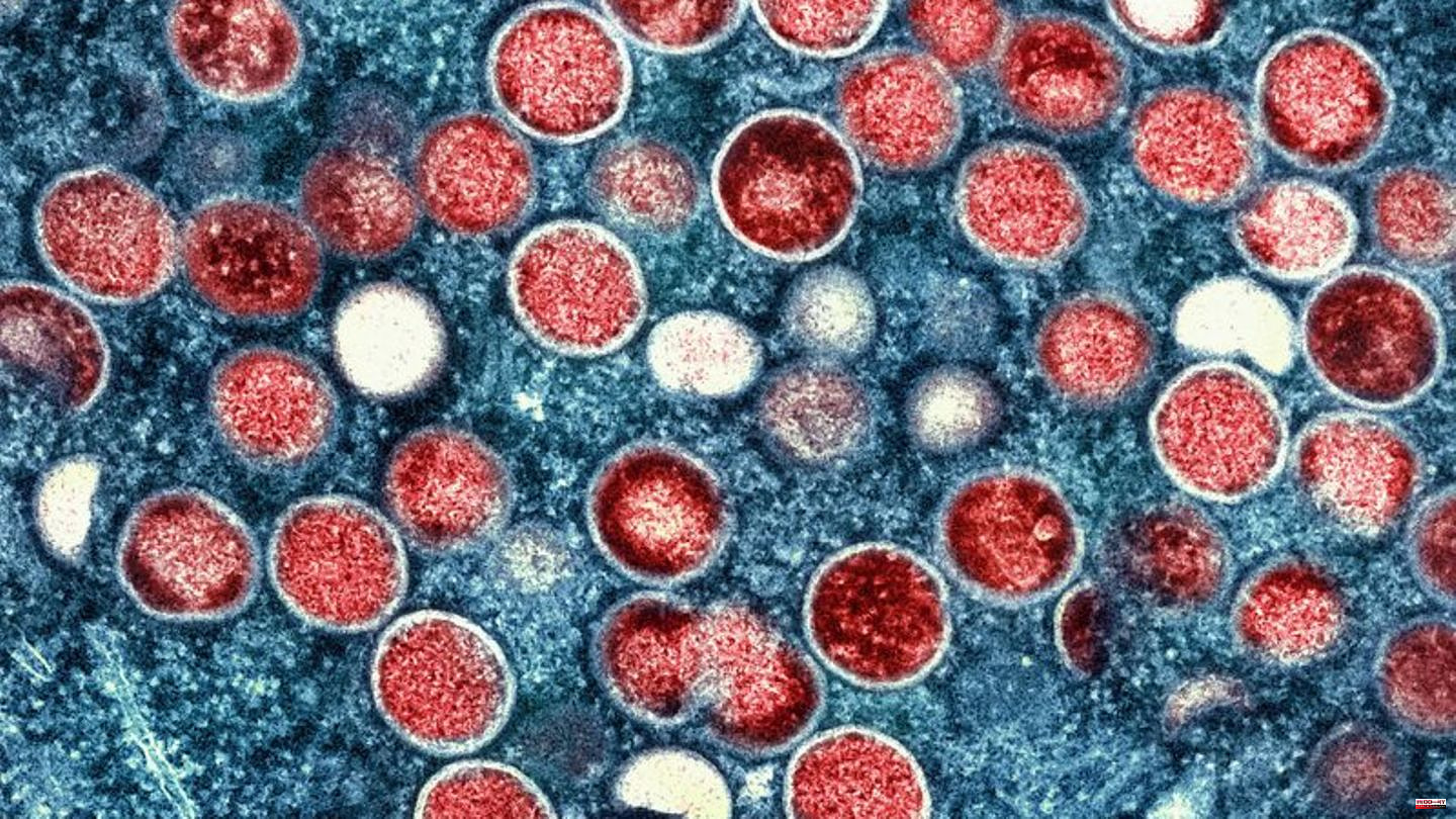 Diseases: WHO warns against false composure in monkeypox