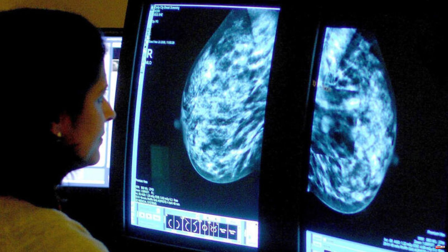 International study: Under 50 and cancer: More and more younger people are being diagnosed