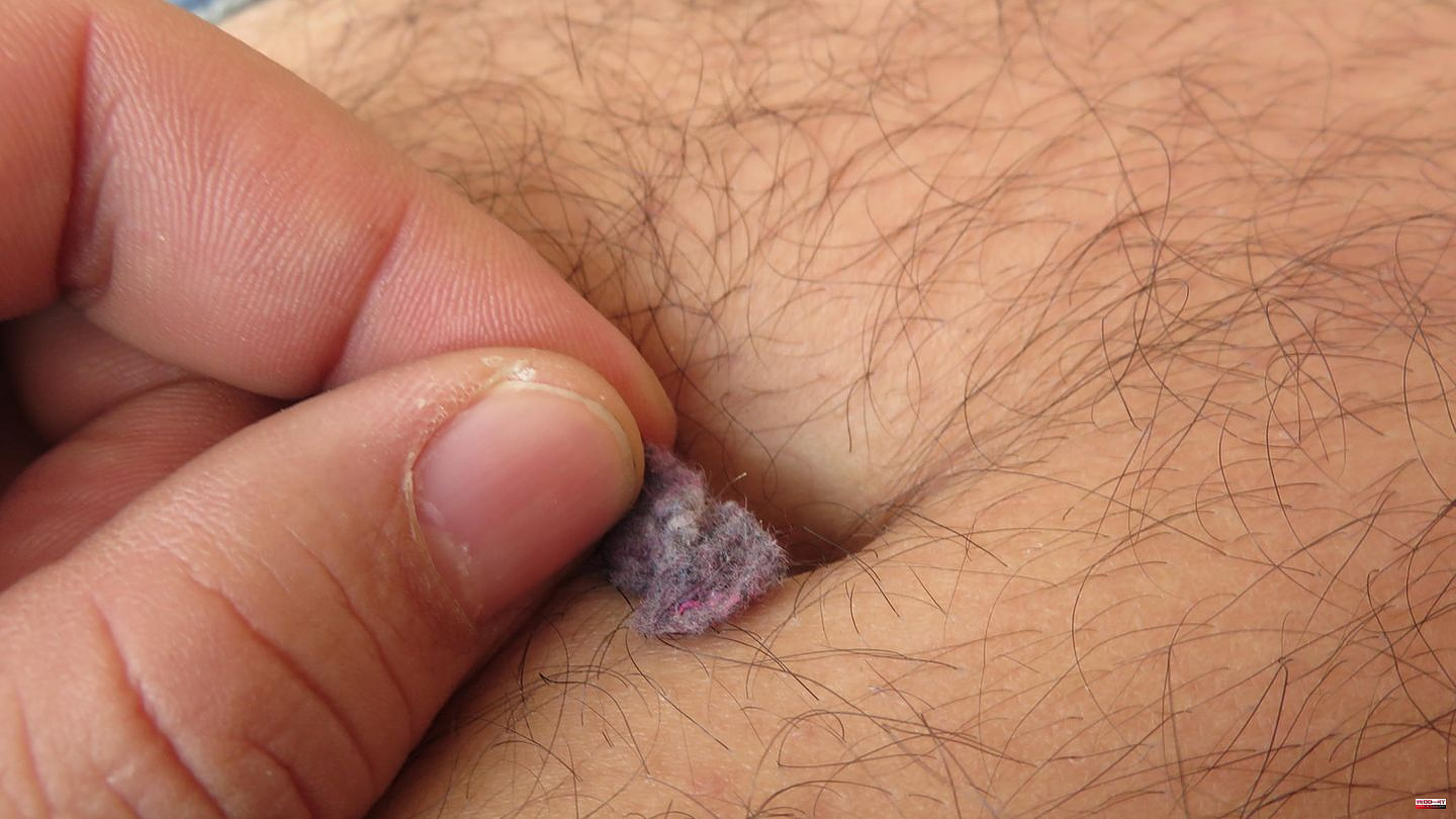 Good to know: Why men have more lint in their belly buttons than women