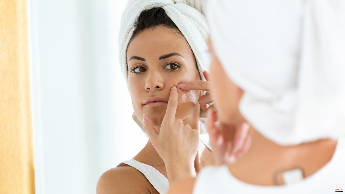 Beauty trick: pimple patches against skin blemishes? That's what lies behind it