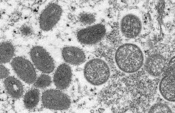WHO: Monkey pox is not a pandemic threat.
