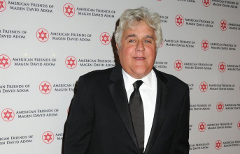 TV legend: After a fire accident: Jay Leno needs a...
