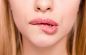 Healthy lips: Lip care for dry and chapped skin: How...
