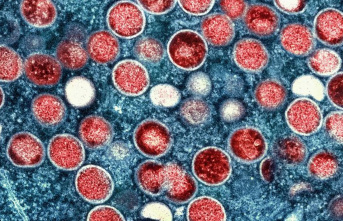 Diseases: Monkeypox outbreak remains public health...