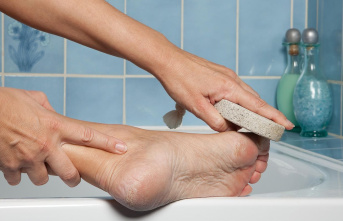 Cracked heels: remove calluses: This will make your...