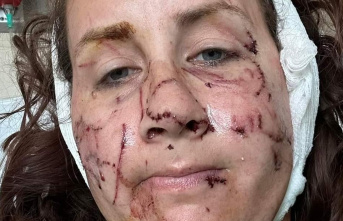 USA: "I was covered in blood": woman is...
