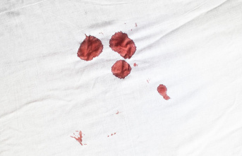 Underestimated suffering: Gynecologist about heavy periods: "There are women who literally bleed out"
