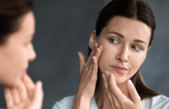 Facial creams: Dry skin on the face: causes, symptoms and proper care