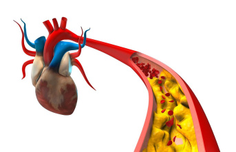 Now considered an independent organ: is the aorta now treated better?