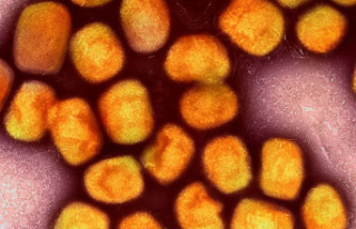 Virus: 14 monkeypox cases in Saxony-Anhalt known so...