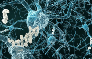 Health: Study: Alzheimer's drug slows mental...