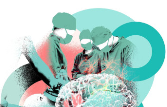 Neurosurgeon at the Berlin Charité: What it's like to operate on a person's brain - while he's awake