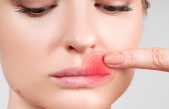 Viral infection: what helps against herpes? How to properly treat cold sores