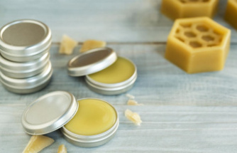 Recipe ideas: make lip balm yourself? You use these ingredients to create your own products